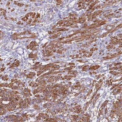 Immunohistochemistry-Paraffin: TIAF1 Antibody [NBP2-13430]