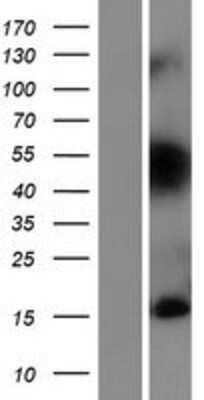 Western Blot: TIAF1 Overexpression Lysate [NBP2-07827]