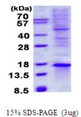 SDS-PAGE: Recombinant Human TIAF1 His Protein [NBP2-22859]