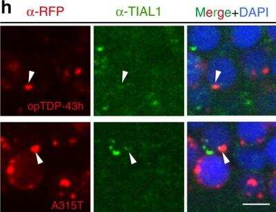 Immunocytochemistry/ Immunofluorescence: TIAL1 Antibody [NBP1-79932]