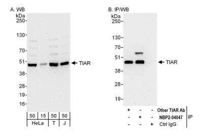 Western Blot: TIAL1 Antibody [NBP2-04047]