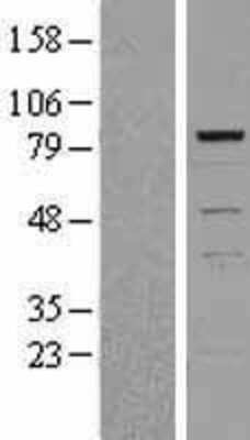 Western Blot: TIAL1 Overexpression Lysate [NBP2-04245]