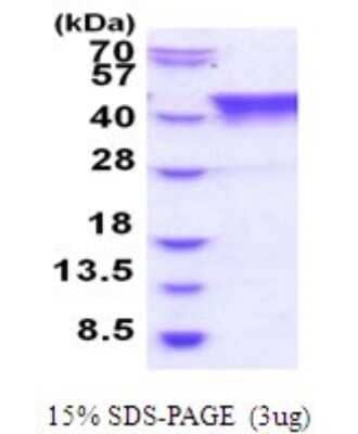 SDS-PAGE: Recombinant Human TIAL1 His Protein [NBP2-51914]