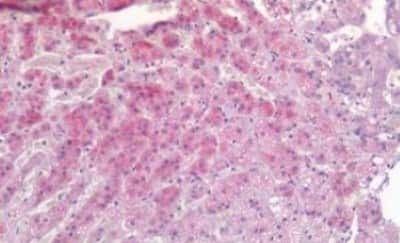 Immunohistochemistry-Paraffin: TIAM1 Antibody [NBP3-14495]