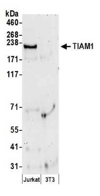 Western Blot: TIAM1 Antibody [NB100-2301]