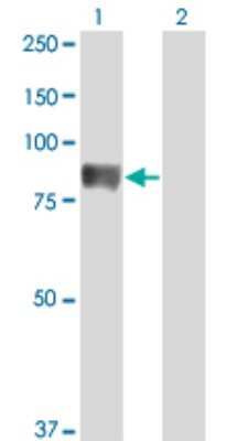 Western Blot: TIAM2 Antibody (3C1) [H00026230-M01]