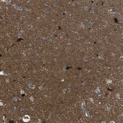 Immunohistochemistry-Paraffin: TIAM2 Antibody [NBP1-80713]