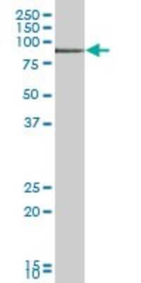 Western Blot: TIAM2 Antibody [H00026230-B01P]