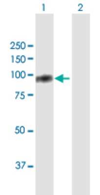 Western Blot: TIAM2 Antibody [H00026230-B01P]