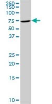 Western Blot: TIAM2 Antibody [H00026230-D01P]