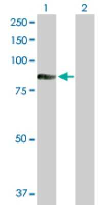 Western Blot: TIAM2 Antibody [H00026230-D01P]
