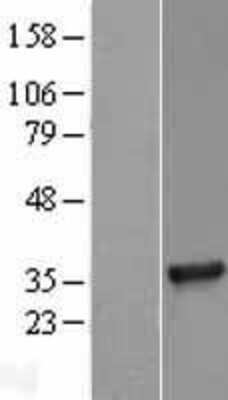 Western Blot: TRAM/TICAM2 Overexpression Lysate [NBL1-16908]