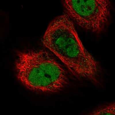 Immunocytochemistry/ Immunofluorescence: TICRR Antibody [NBP2-58491]