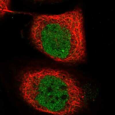 Immunocytochemistry/ Immunofluorescence: TICRR Antibody [NBP2-68674]