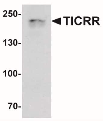 Western Blot: TICRR AntibodyBSA Free [NBP2-41283]