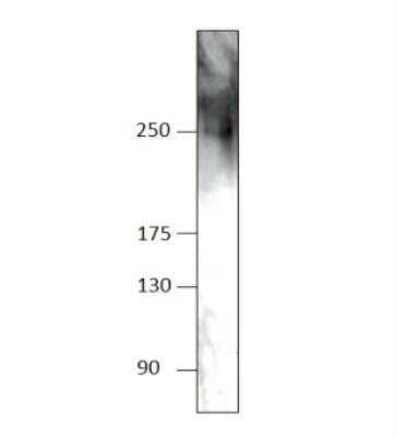 Western Blot: TICRR Antibody [NBP3-12499]