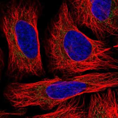 Immunocytochemistry/ Immunofluorescence: TID1 Antibody [NBP2-33416]