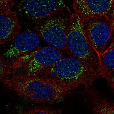 Immunocytochemistry/ Immunofluorescence: TID1 Antibody [NBP2-34066]