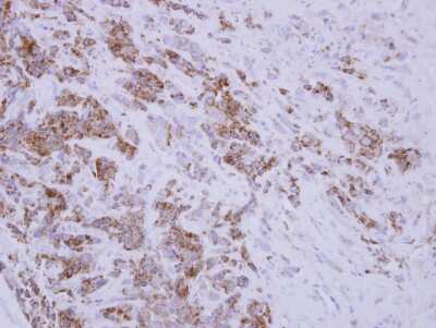 Immunohistochemistry-Paraffin: TID1 Antibody [NBP2-20633]