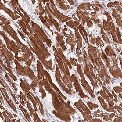 Immunohistochemistry-Paraffin: TID1 Antibody [NBP2-34066]