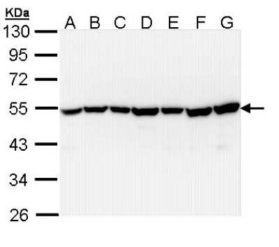 Western Blot: TID1 Antibody [NBP1-33387]