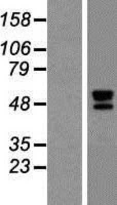 Western Blot: TID1 Overexpression Lysate [NBP2-10517]