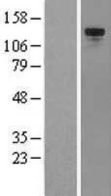 Western Blot: Tie-2 Overexpression Lysate [NBL1-16808]