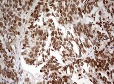 Immunohistochemistry: TIF1 alpha Antibody (OTI2D9) [NBP2-46213]