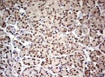 Immunohistochemistry: TIF1 alpha Antibody (OTI2D9) [NBP2-46213]