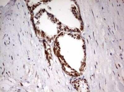 Immunohistochemistry: TIF1 alpha Antibody (OTI2D9) [NBP2-46213]
