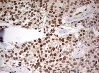 Immunohistochemistry: TIF1 alpha Antibody (OTI2D9) [NBP2-46213]