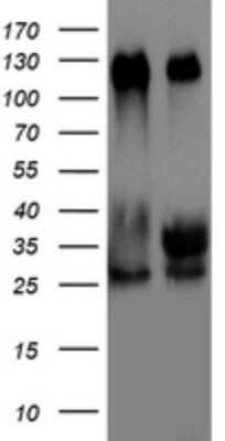 Western Blot: TIF1 alpha Antibody (OTI2D9) [NBP2-46213]