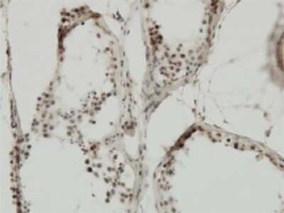 Immunohistochemistry-Paraffin: TIF1 alpha Antibody (2F2) [H00008805-M01]