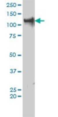 Western Blot: TIF1 alpha Antibody (2F2) [H00008805-M01]
