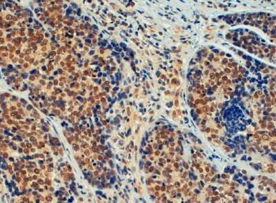 Immunohistochemistry-Paraffin: TIF1 alpha Antibody [NB300-847]