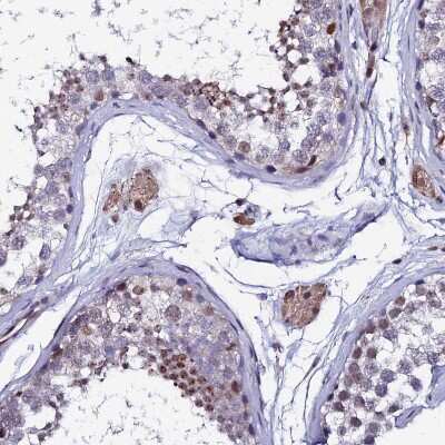 Immunohistochemistry-Paraffin: TIF1 alpha Antibody [NBP1-92506]