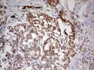 Immunohistochemistry: TIF1 alpha Antibody (OTI2D9) - Azide and BSA Free [NBP2-74514]