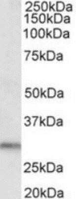 Western Blot: TIF1 alpha Antibody [NB300-847]