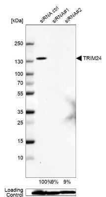 Western Blot: TIF1 alpha Antibody [NBP1-92506]