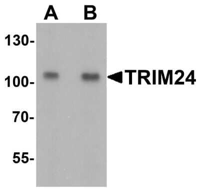 Western Blot: TIF1 alpha AntibodyBSA Free [NBP2-41220]