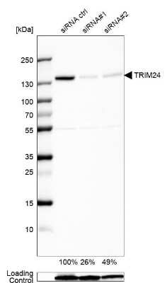 Western Blot: TIF1 alpha Antibody [NBP2-56418]