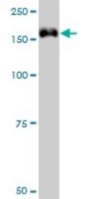 Western Blot: TIF1 gamma Antibody (6D1) [H00051592-M01]