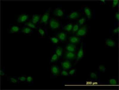 Immunocytochemistry/ Immunofluorescence: TIF1 gamma Antibody (6F4) [H00051592-M02]