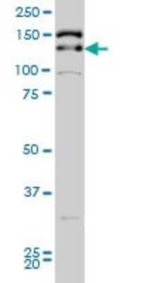 Western Blot: TIF1 gamma Antibody (6F4) [H00051592-M02]