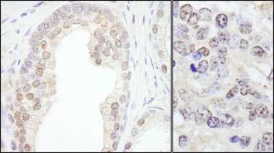 Immunohistochemistry-Paraffin: TIF1 gamma Antibody [NB100-57498]