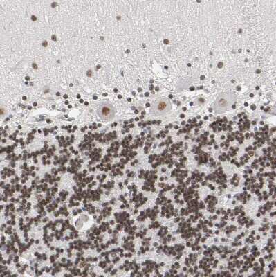 Immunohistochemistry-Paraffin: TIF1 gamma Antibody [NBP1-83747]