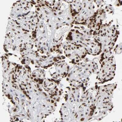 Immunohistochemistry-Paraffin: TIF1 gamma Antibody [NBP1-83747]