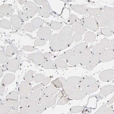 Immunohistochemistry-Paraffin: TIF1 gamma Antibody [NBP1-83747]