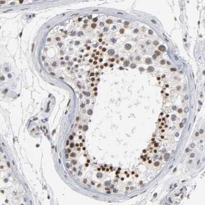 Immunohistochemistry-Paraffin: TIF1 gamma Antibody [NBP1-83747]
