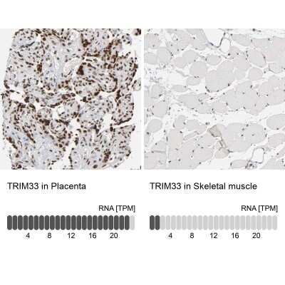 Immunohistochemistry-Paraffin: TIF1 gamma Antibody [NBP1-83747]